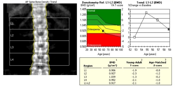 India Cricket Overhaul, Indian Team Performance Review Meeting, BCCI, DEXA Test, Yo-Yo Test, BCCI Workload management, BCCI Dexa Test, Dexa test for Players