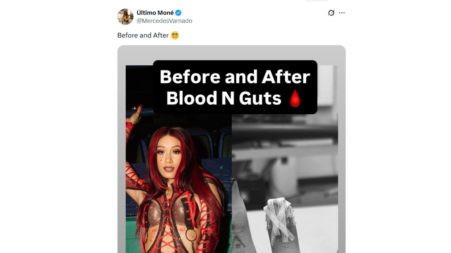 Mercedes Mone shows off her "injuries" after Blood and Guts [Source : Mone's X profile]