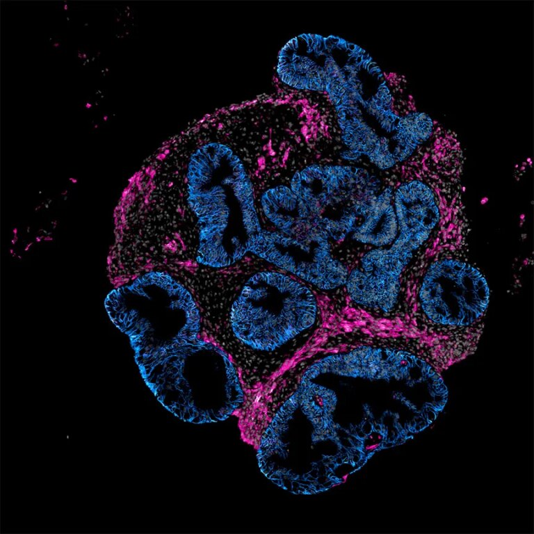 Intero Biosystems desires drugmakers to check on mini human intestines, not animals | TechCrunch